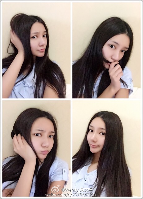 kycom-子宫颈癌晚期的并发症(图3)