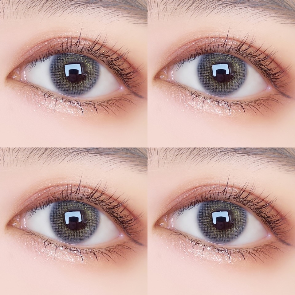 ‘kycom’阴道炎,女性危害(图1) ‘kycom’阴道炎,女性危害(图1)